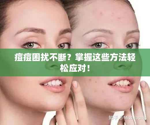 痘痘困扰不断？掌握这些方法轻松应对！